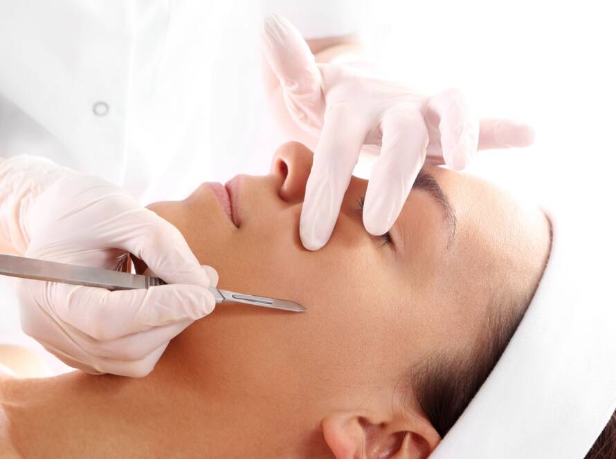 Dermaplaning treatment in New Westminster