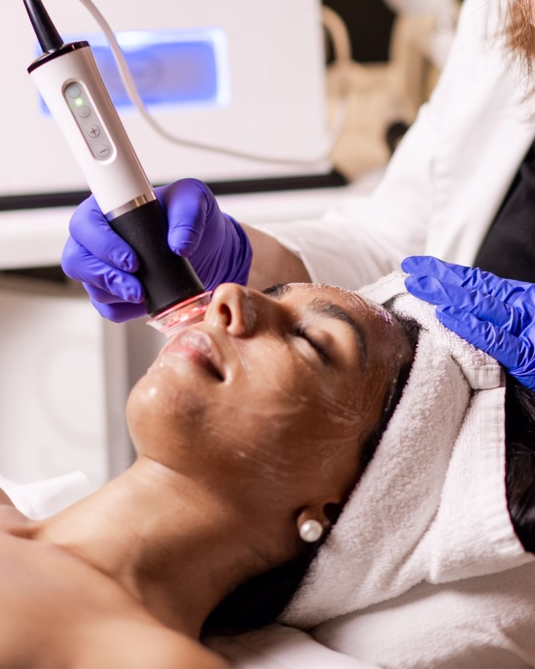 OxyGeneo super facial at New Westminster