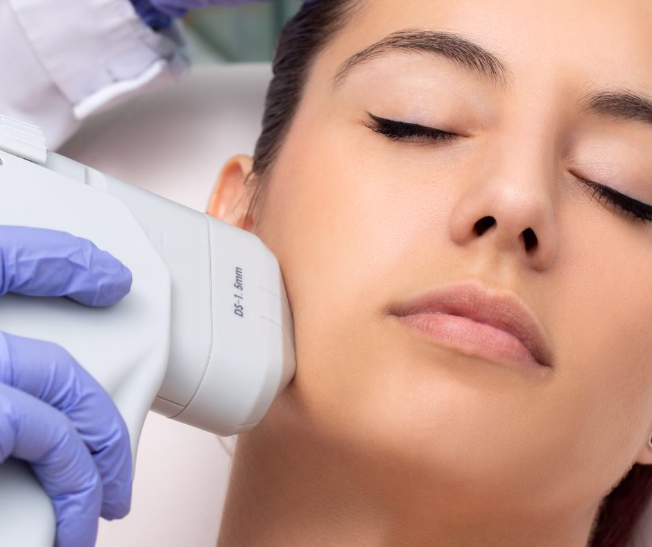 non surgical HIFU skin tightening in Vancouver