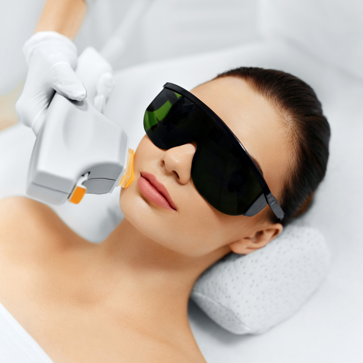 Bio Microneedling SQT in New Westminster