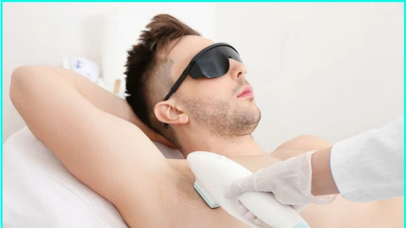Laser hair removal underarm men