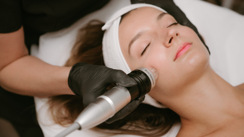 Microneedling session cost Vancouver clinic