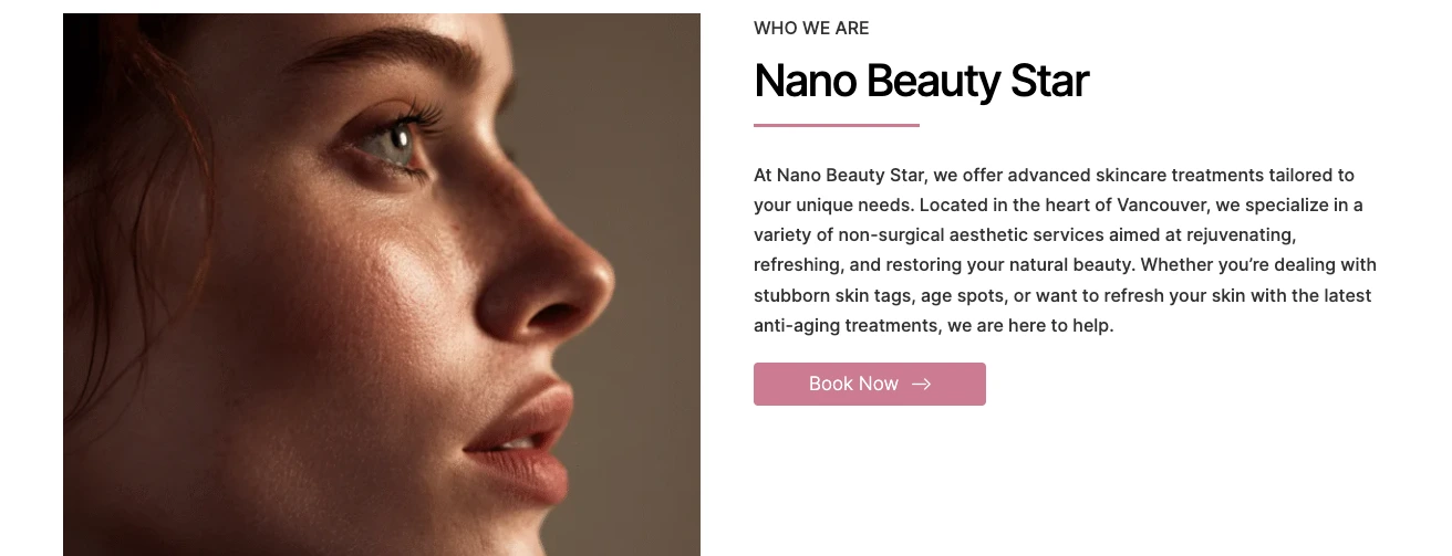 Nano Beauty Star microneedling clinic in Vancouver