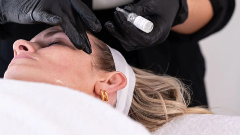 PRP microneedling Vancouver advanced treatment