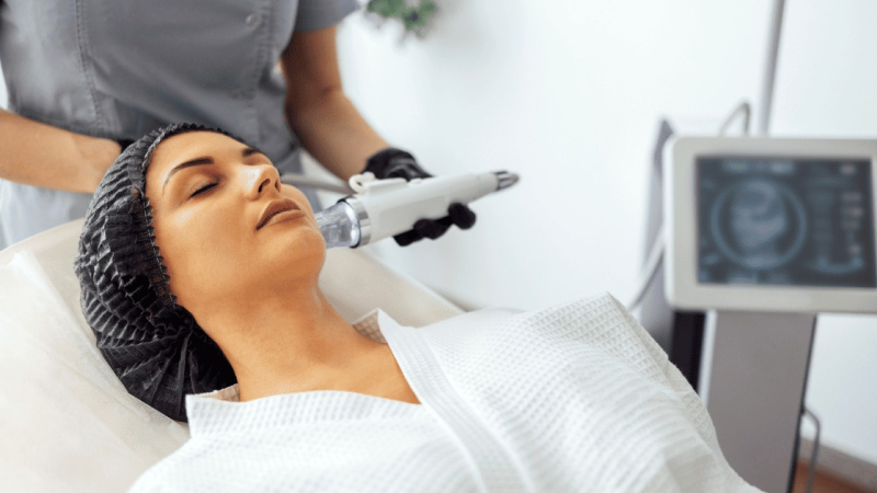 Microneedling facial treatment for skin renewal