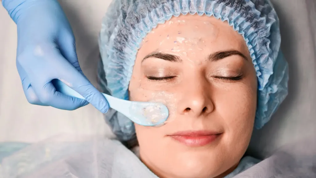 Benefits of Secret RF for enlarged pores and skin rejuvenation.