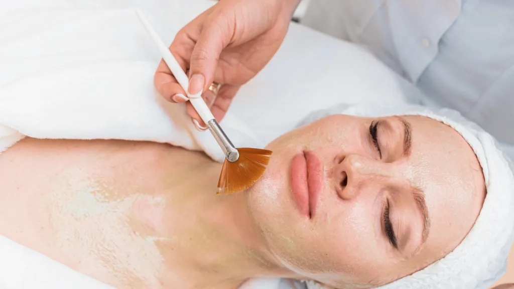 How bio re peel with microneedling skin treatment works.