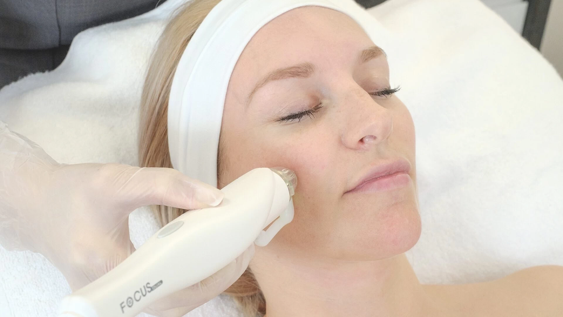 RF micro needling radio frequency before and after care.