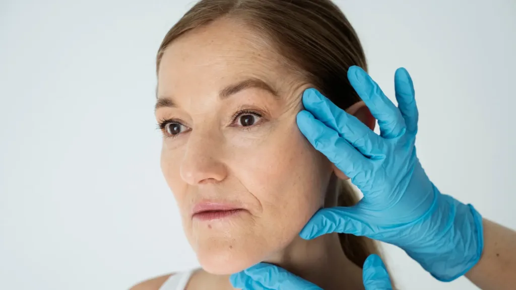 Secret RF benefits for fine lines, wrinkles, and skin rejuvenation.