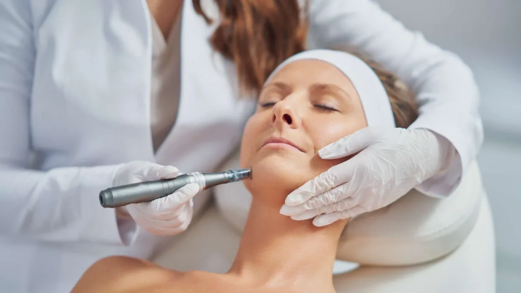 Secret RF facial treatment designed to support smoother and healthier-looking skin.
