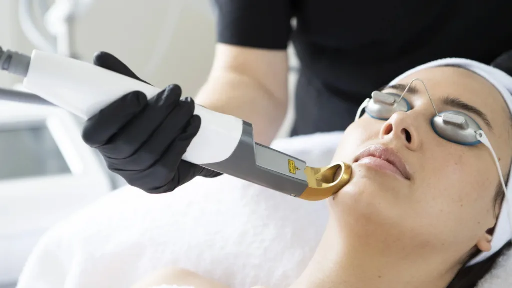 Secret RF vs Potenza cost comparison for skin treatment.