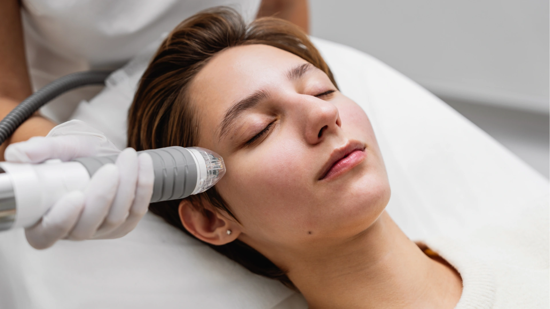 Know what is Rf micro needling radio frequency before and after.