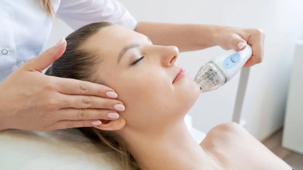 Secret rf microneedling cost in Vancouver vs traditional microneedling.