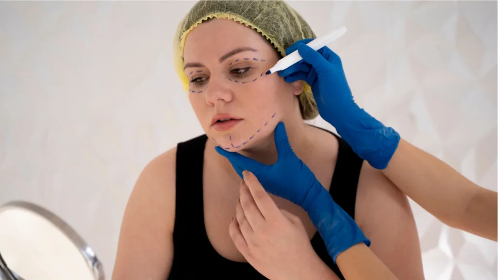 Comparison of lutronic infini vs secret rf for acne scar treatment differences and skin results.