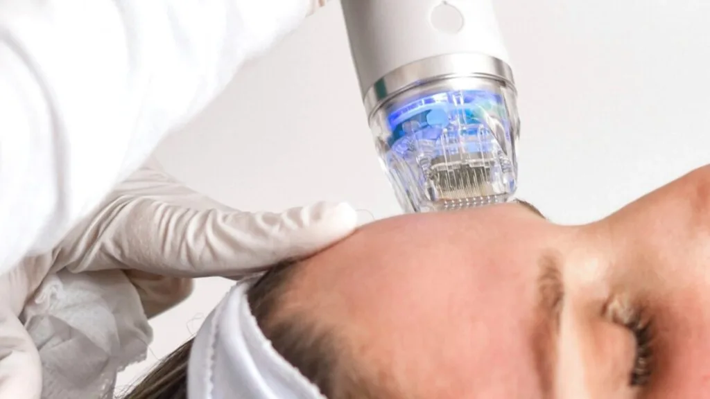 Comparing Secret RF and Secret Pro technologies used in skin treatment procedures. 