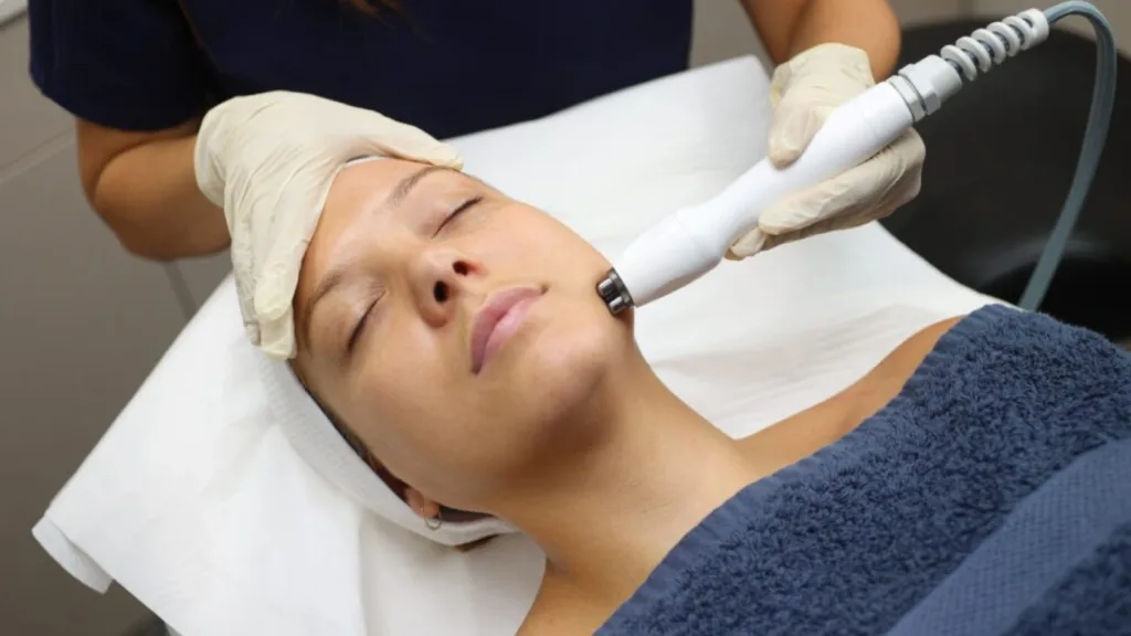 Secret RF microneedling vs Vivace for skin tightening treatments.