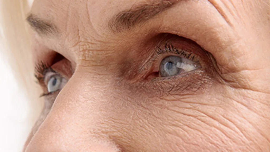 secret-rf-vs-vivace-fine-lines-and-wrinkles