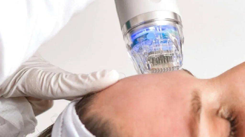 Know how Secret RF results may vary based on skin type and age.