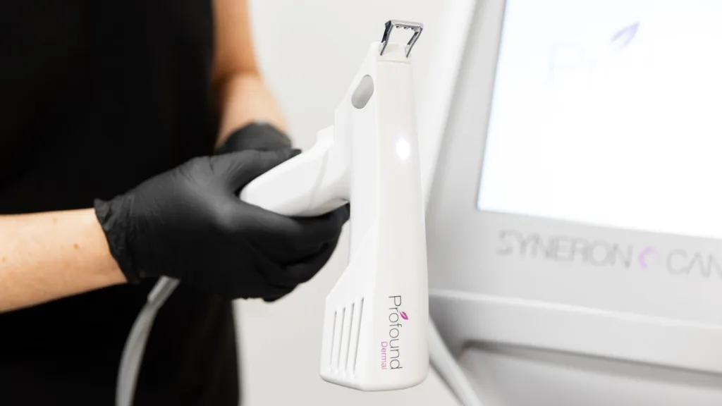 Know what is Profound RF vs Secret RF treatment. 