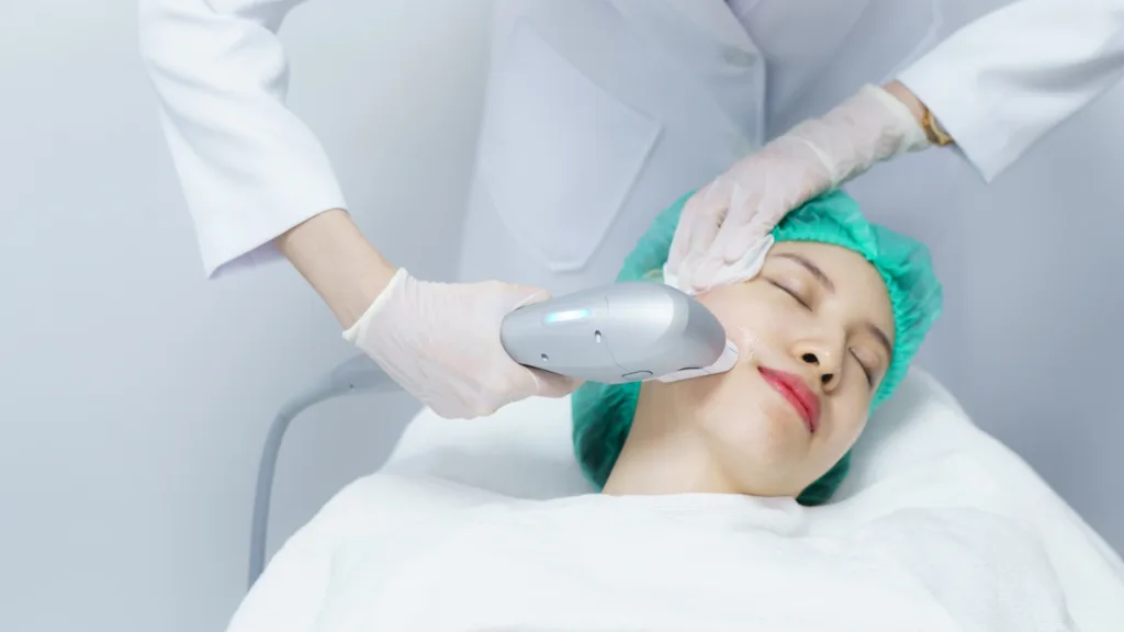 HIFU facial treatment side effects.
