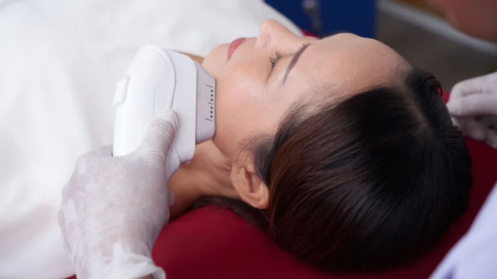 Number of HIFU facial sessions you need. 