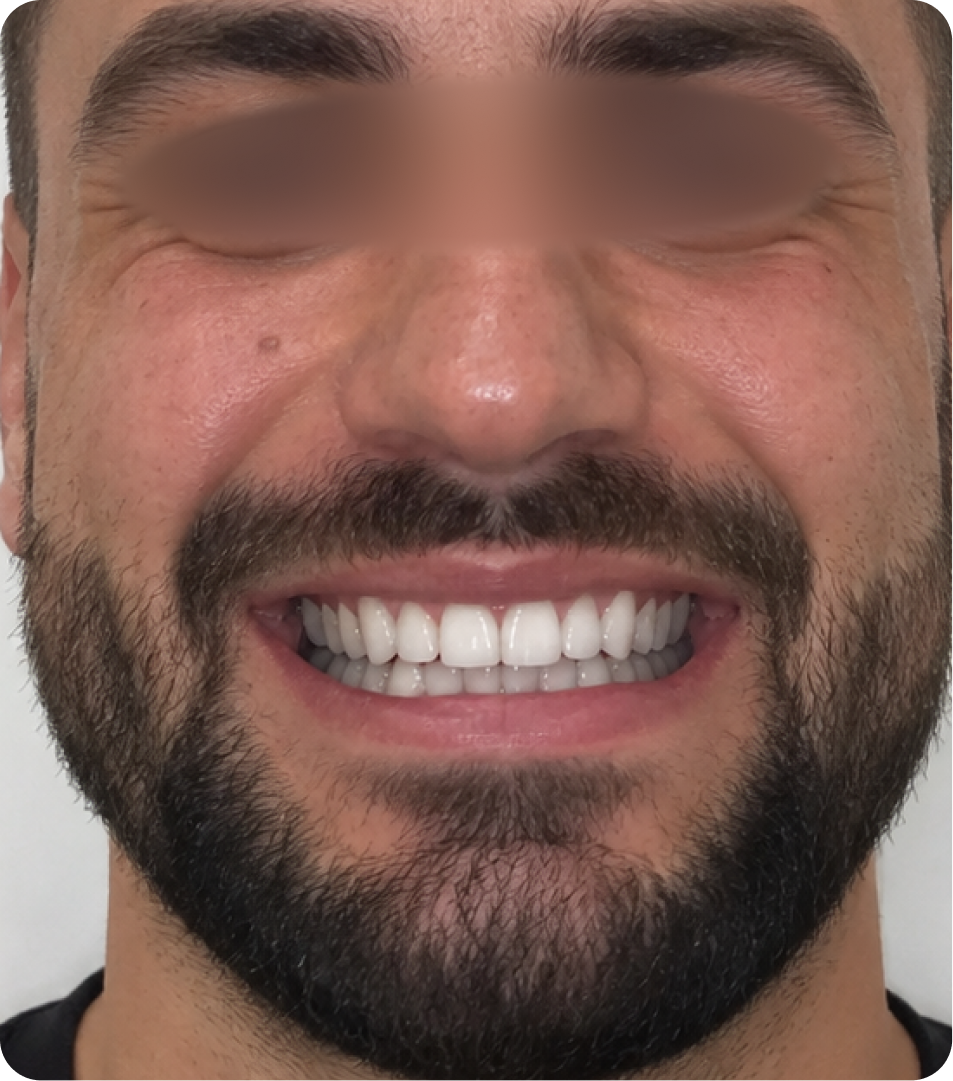 After