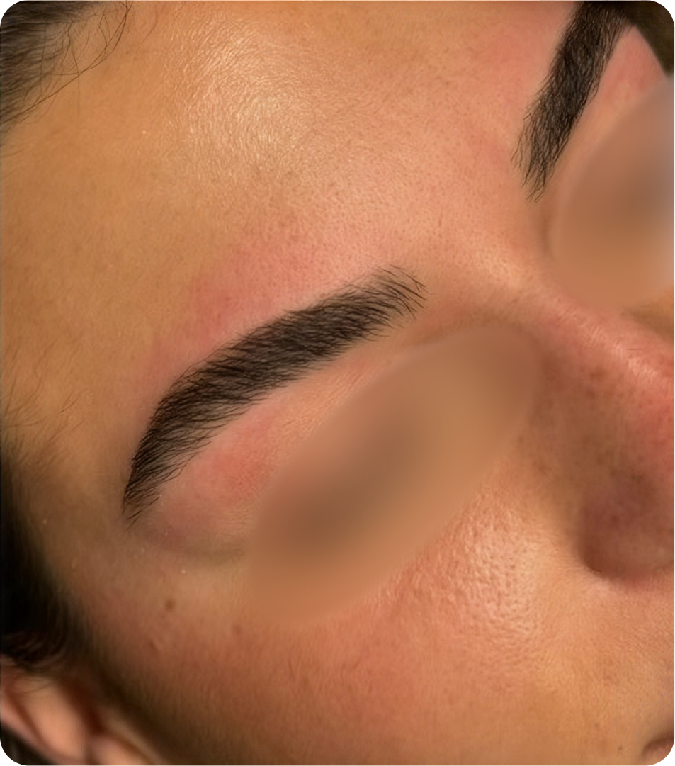 After