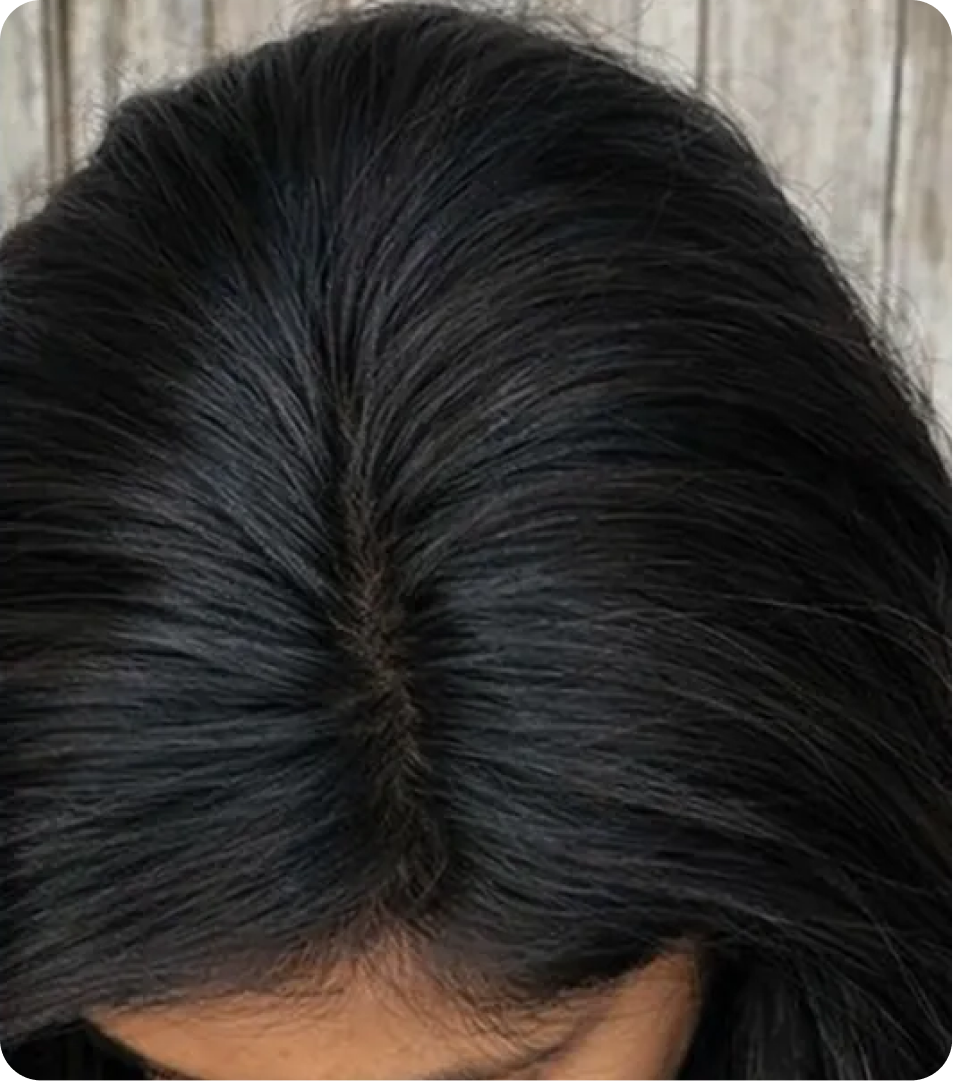 After
