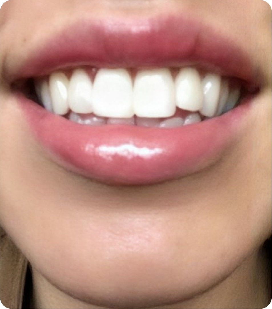 After