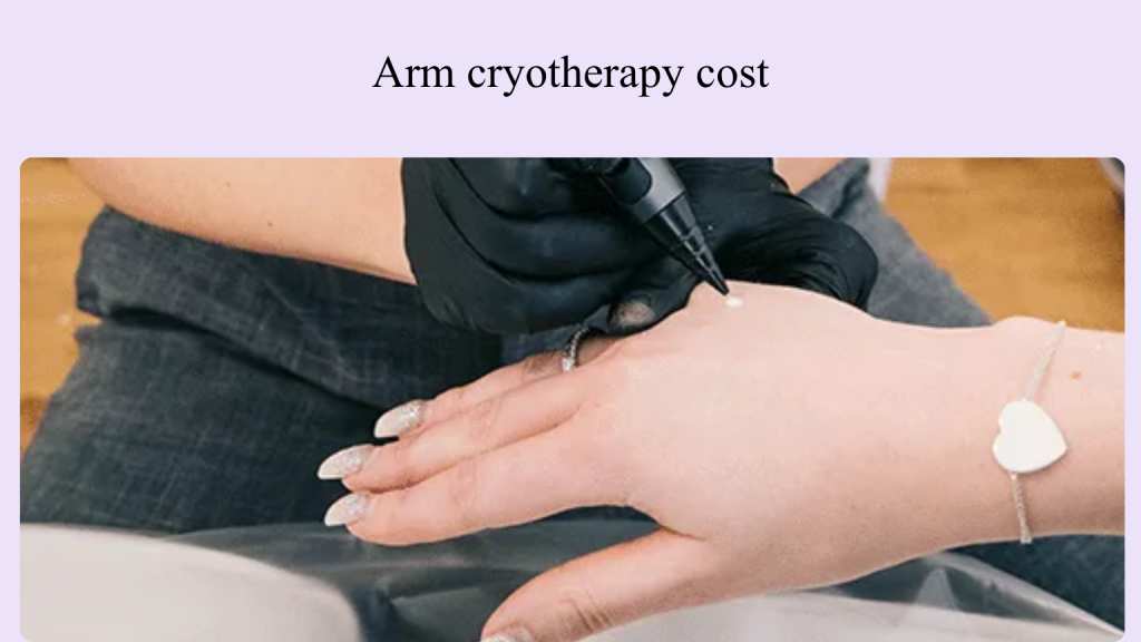 Arm cryotherapy cost Vancouver.