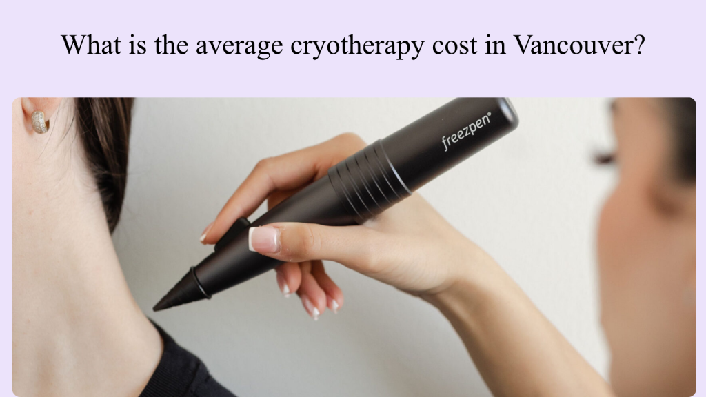 Average cryotherapy cost Vancouver.