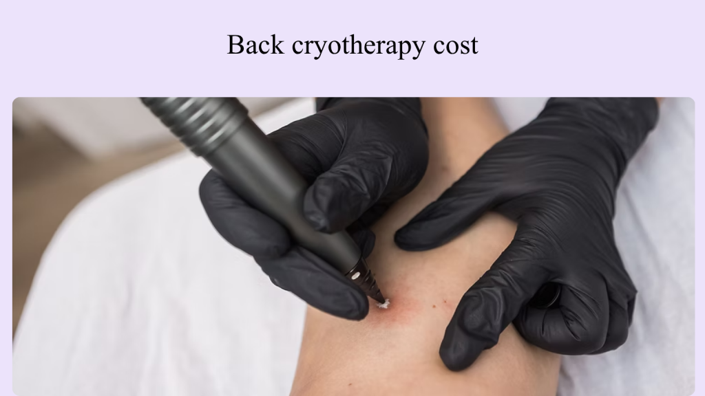 Back cryotherapy cost Vancouver.