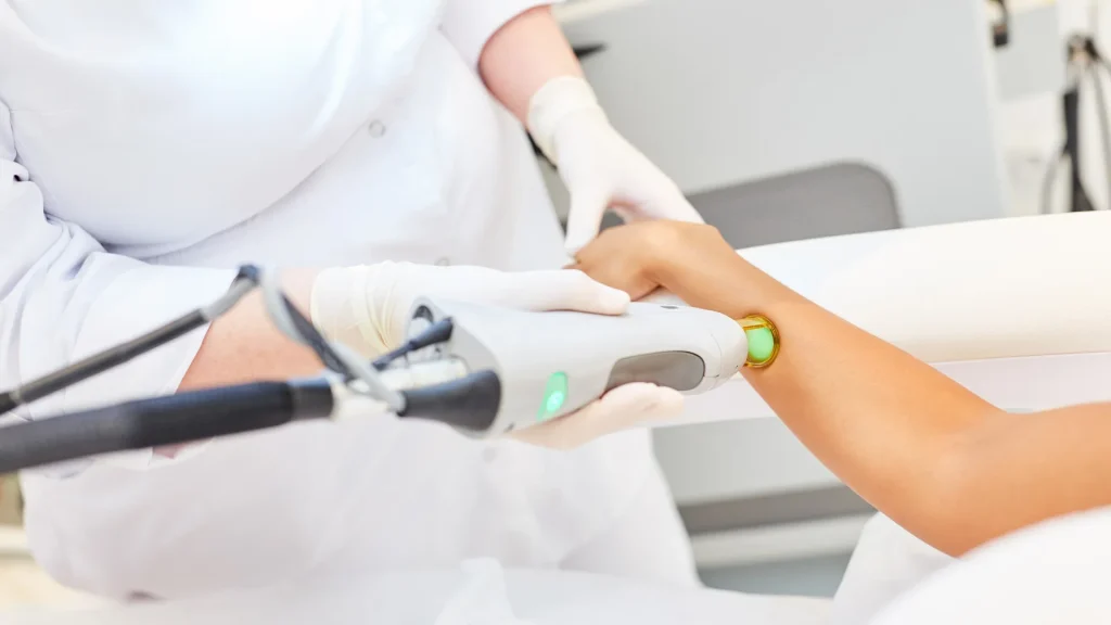 Choosing the right laser hair removal technology in Vancouver.