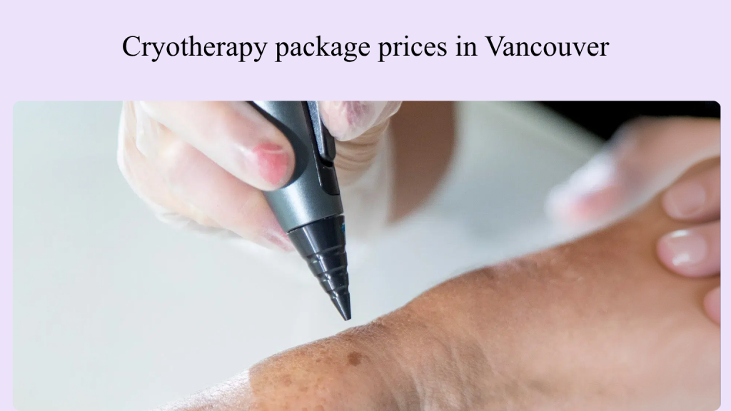 Cryotherapy package prices in Vancouver