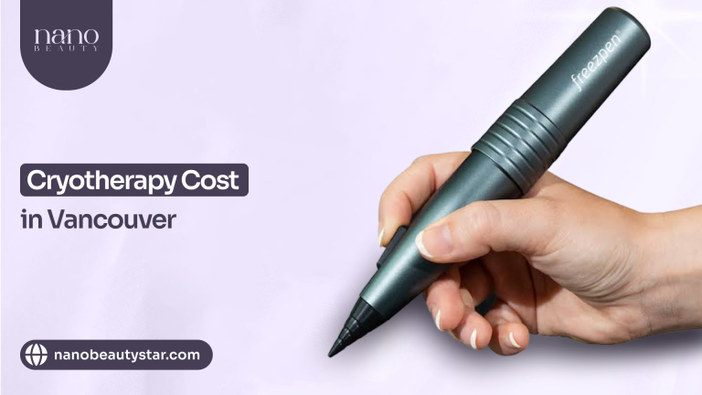 Cryotherapy Vancouver cost guide.