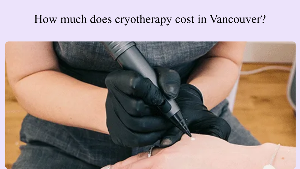 Cryotherapy Vancouver prices.