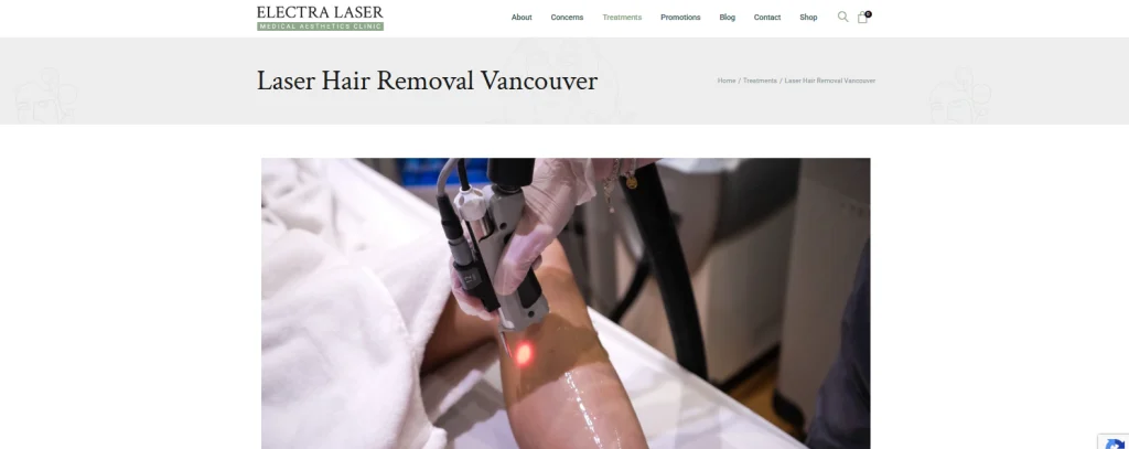 Electra Laser - laser hair removal dark skin Vancouver.