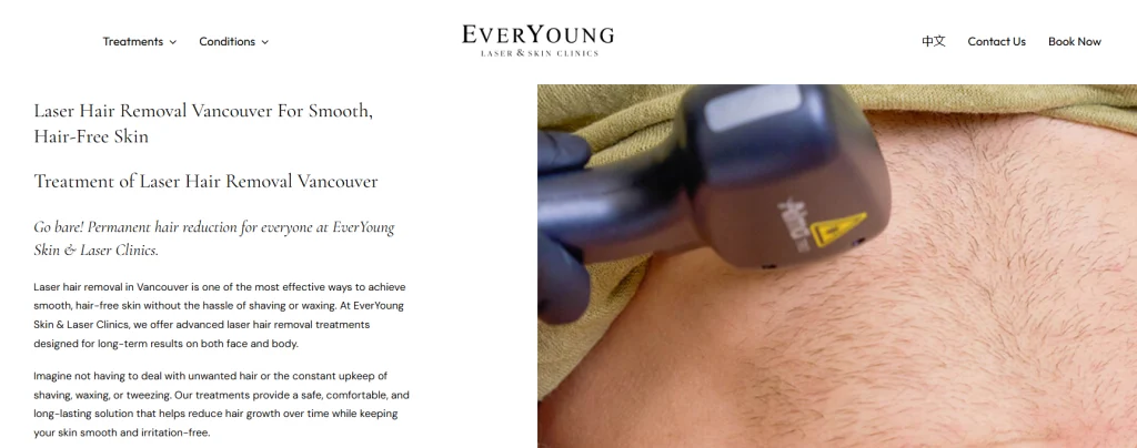 Everyoung Laser & Skin Clinics - laser hair removal North Vancouver.