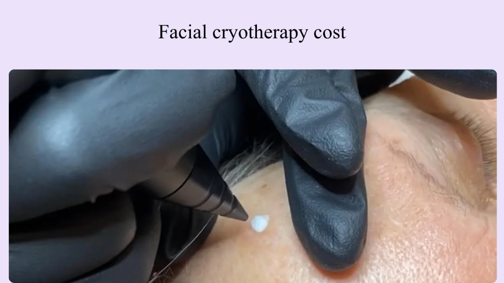 Facial cryotherapy cost Vancouver.