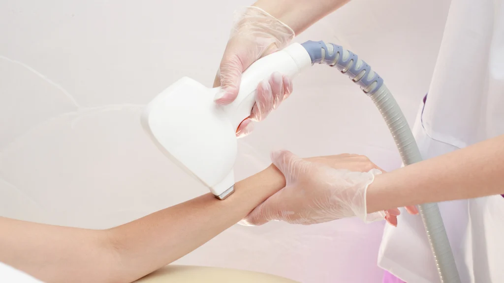 Laser hair removal in West Vancouver.