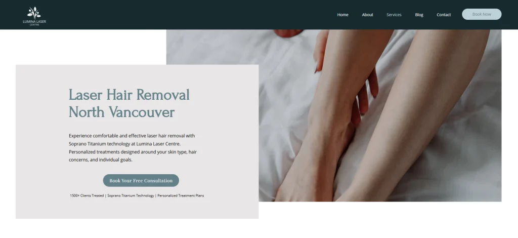 Lumina Laser - laser hair removal North Vancouver.
