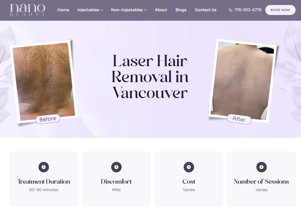 Nano Beauty Star - laser hair removal Downtown Vancouver.