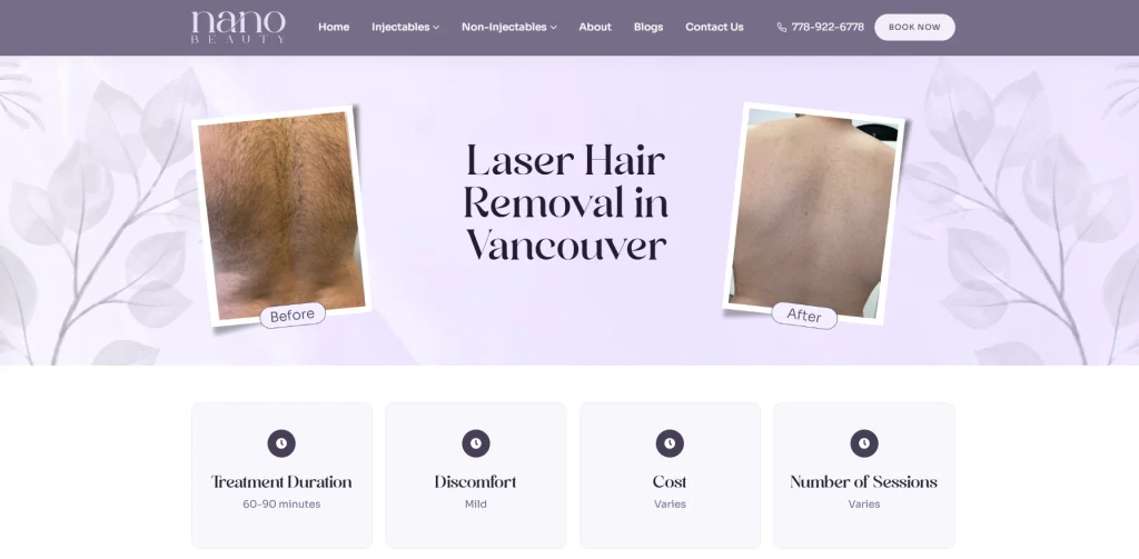 Nano Beauty Star - laser hair removal North Vancouver.