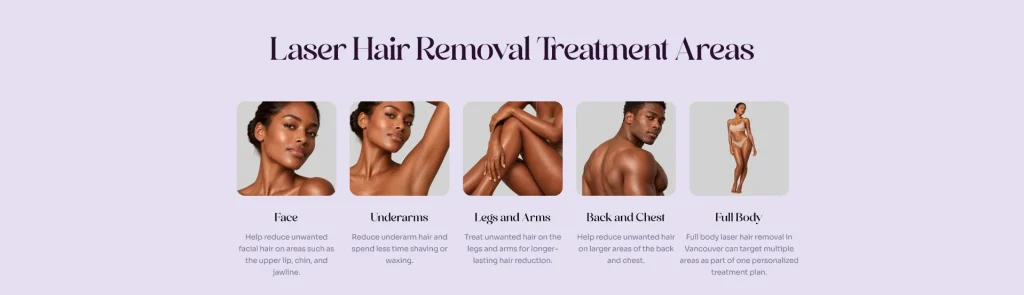 Nano Beauty Star - laser hair removal for dark skin Vancouver.