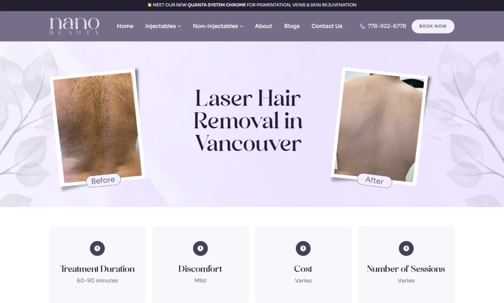 Nano Beauty Star - laser hair removal West Vancouver.