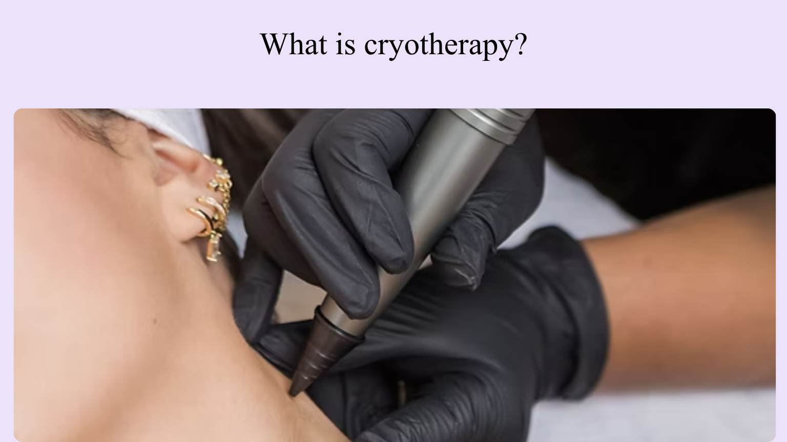 What is cryotherapy Vancouver.