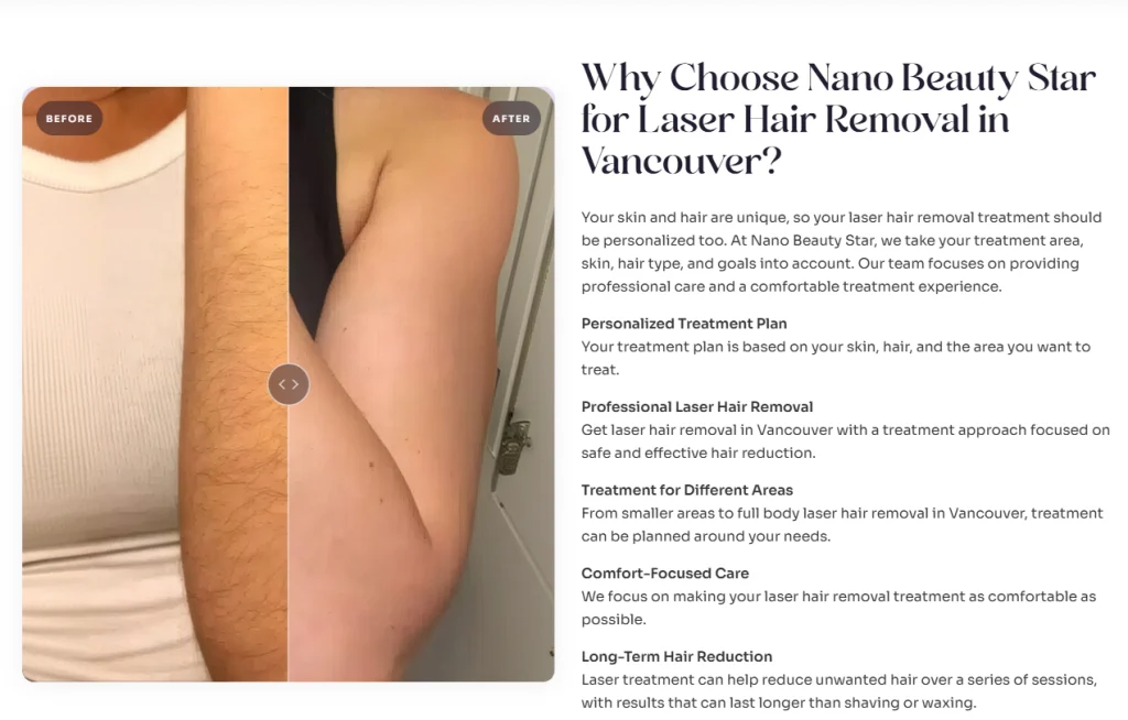 Why choose Nano Beauty Star for laser hair removal.
